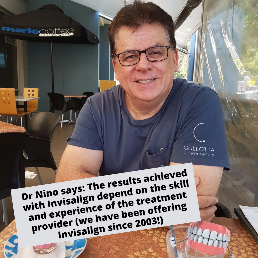 Invisalign Experience