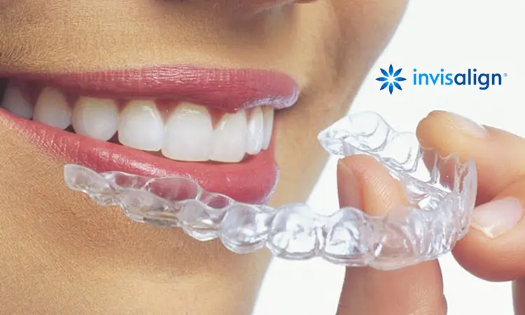 Invisalign Blog