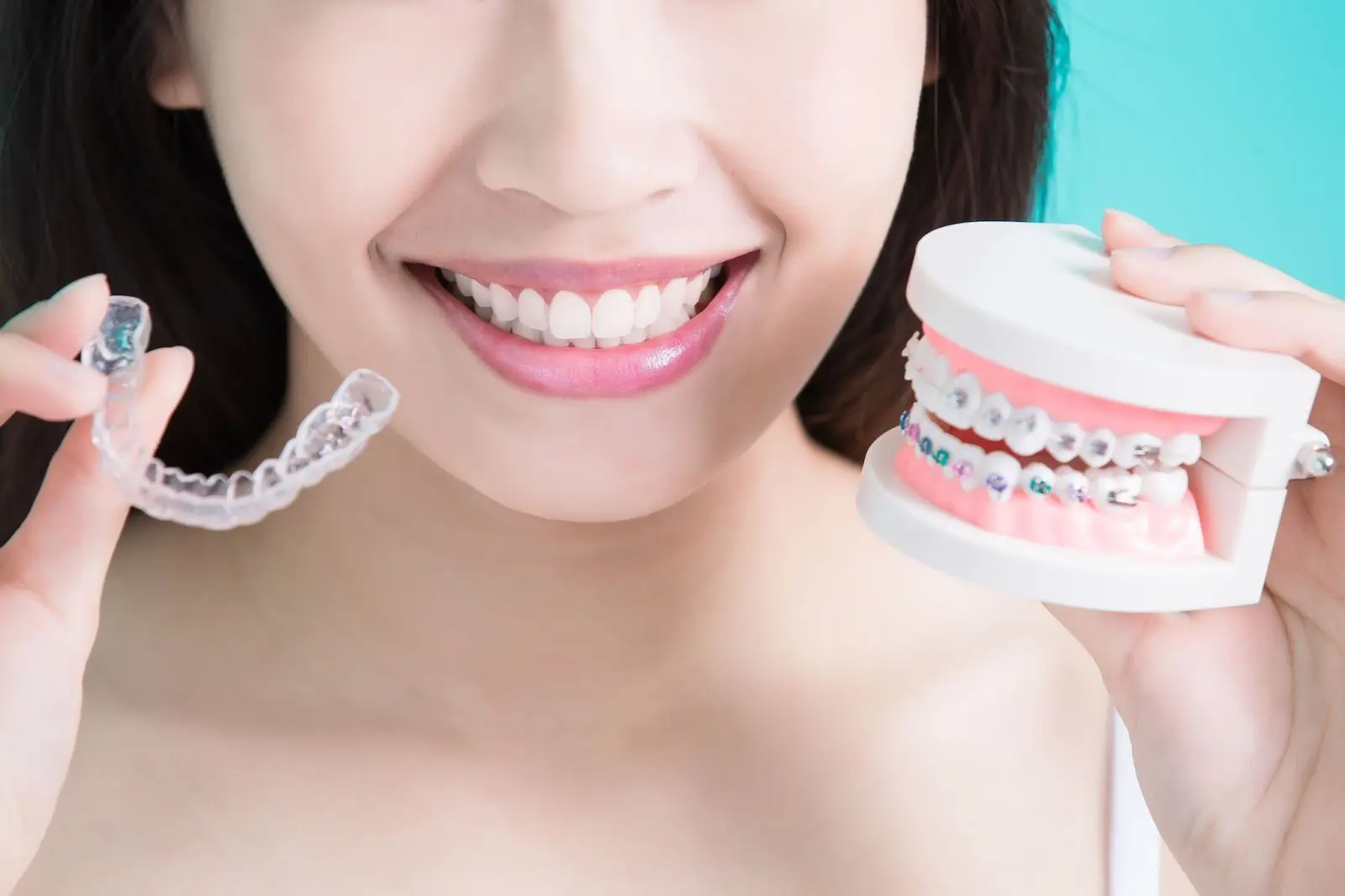 Lightforce Braces Vs Invisalign