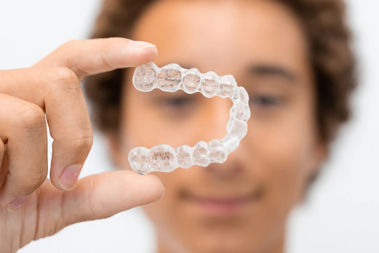 Gul Clear Aligners 1 615x410 1