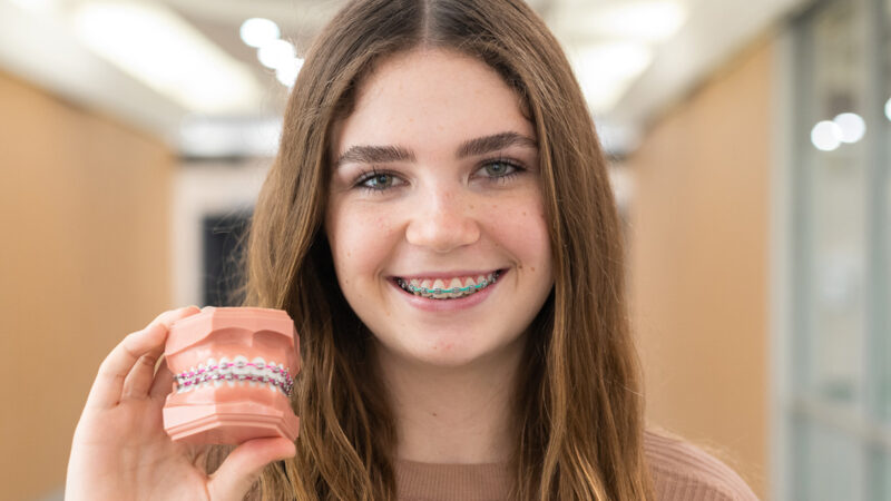 A girl showing the model of braces