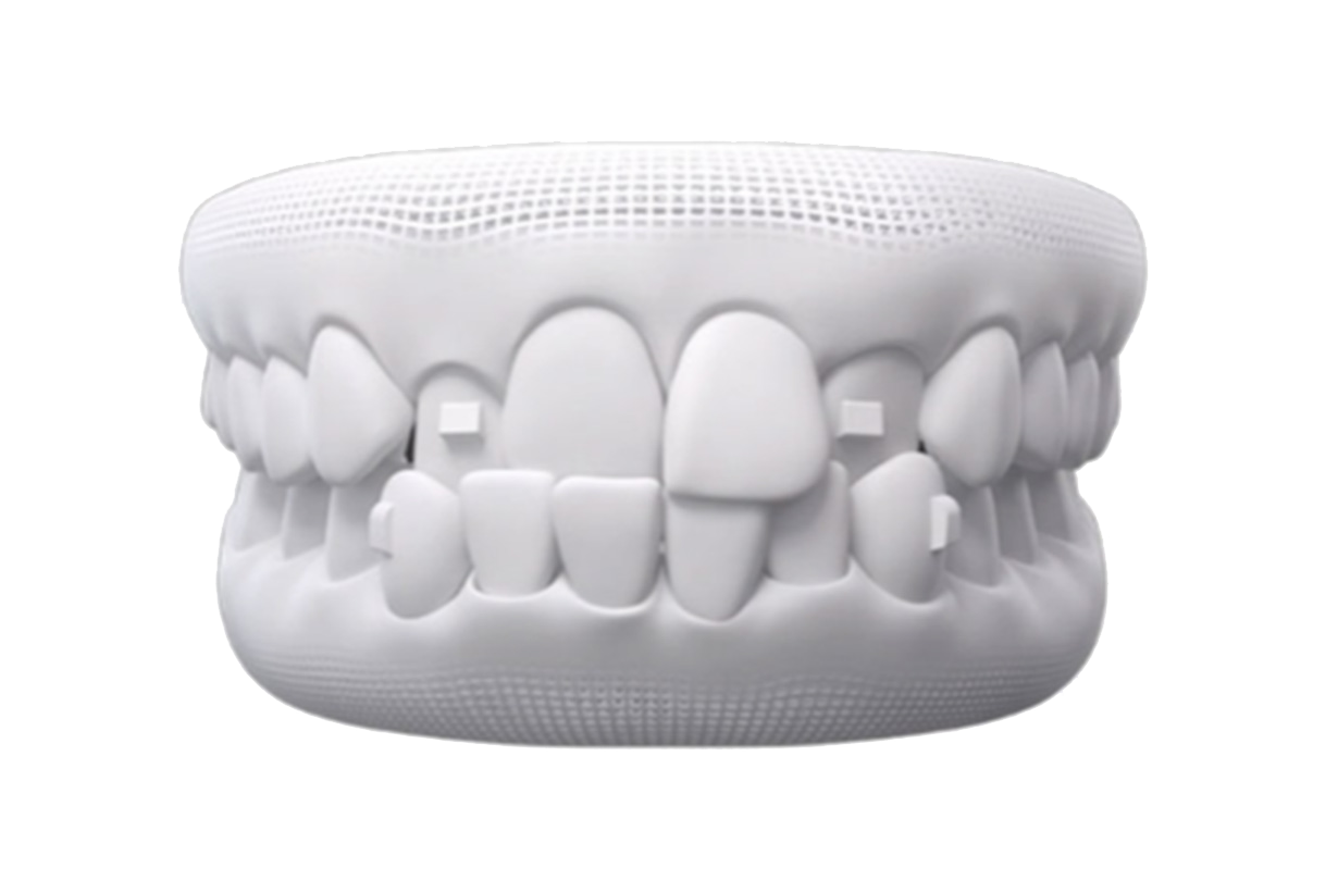 Clear aligners attachments